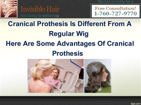 What is cranial prosthesis And Its Benefits