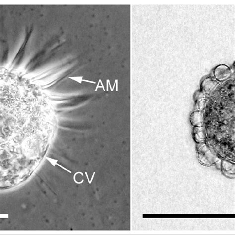 Live Specimens Of Meseres Corlissi CCAP 1647 1 Active Left And