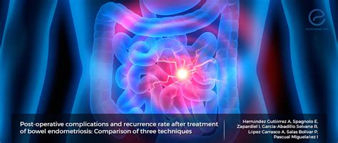 Which surgical approach for bowel endometriosis? | EndoNews