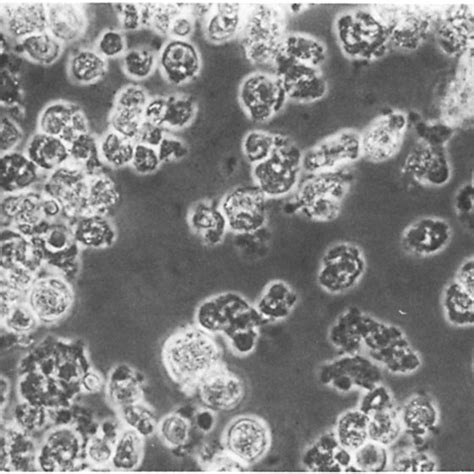 Uninfected HEp 2 cells. Haematoxylin and eosin stain. Fig. 2. HEp2 ...