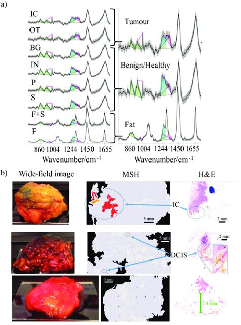 A Left Mean Of Raman Spectra Corresponding To Normal Breast Tissue