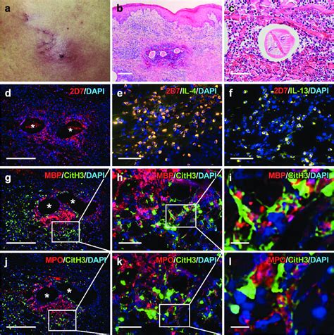 Clinical Histopatho Logical And Immunofluore Scence Staining