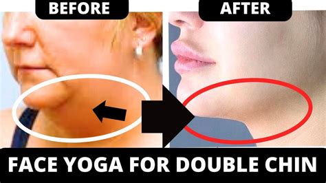 FACE YOGA EXERCISES FOR DOUBLE CHIN GET RID OF DOUBLE CHIN YouTube