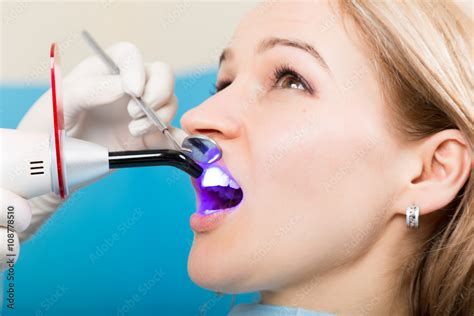 The Reception Was At The Female Dentist Doctor Examines The Oral