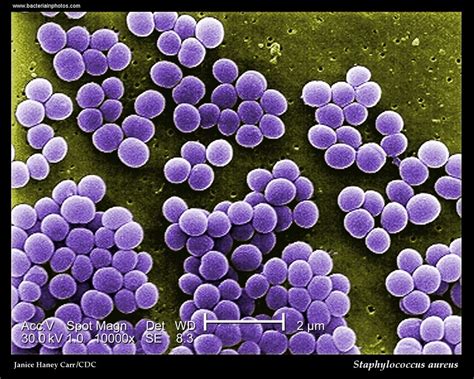 Indentifikacija Bakterija Roda Staphylococcus