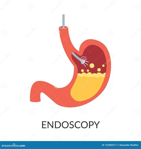 Esophagus Endoscopy Procedure Cartoon Vector | CartoonDealer.com #226254377