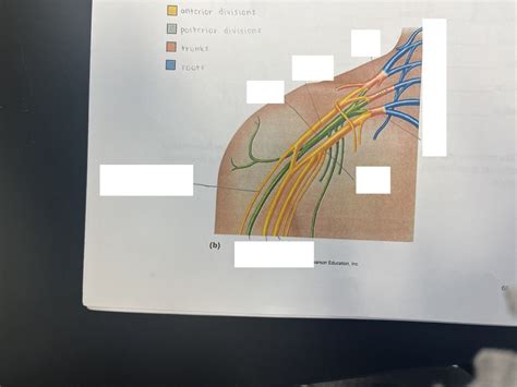 Anatomy Practical Brachial Plexus Diagram Quizlet