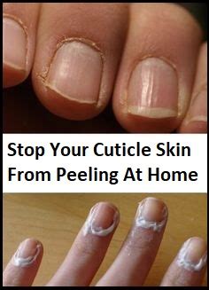 Home Remedy To Stop Your Cuticle Skin From Peeling Naturally Awarenesses