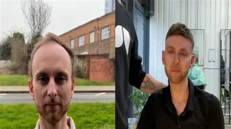 Video Of Bald Man's Hair Transformation Takes Internet By Storm | Buzz ...
