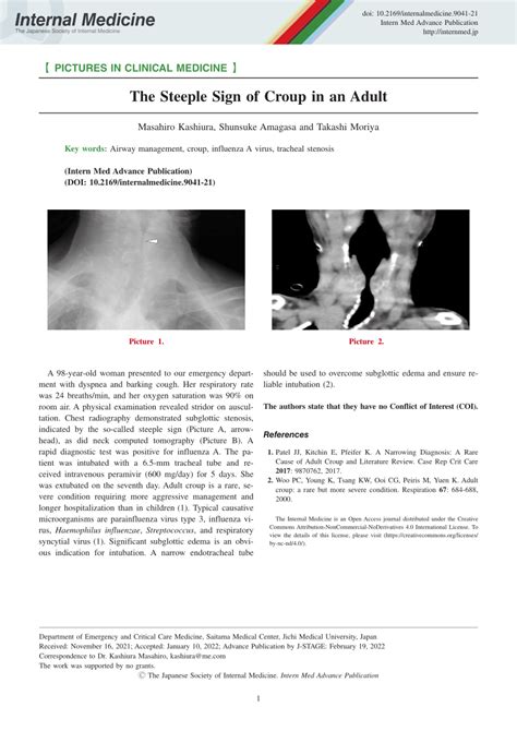 Pdf The Steeple Sign Of Croup In An Adult