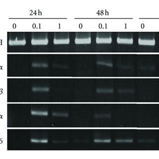 Expression Of Pro Inflammatory Cytokine Genes In Human Gingival