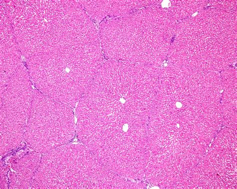 Hepatic Lobule Histology