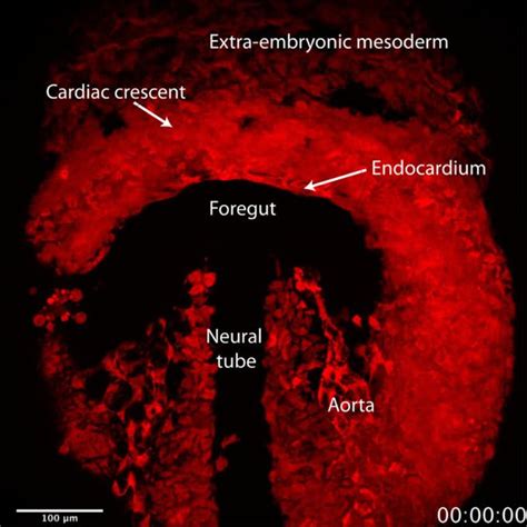 Live Imaging Of Heart Tube Development In Mouse Reveals Alternating