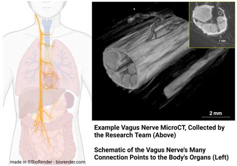 National Institutes Of Health Awards M To Research Team Led By