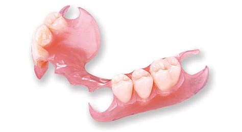 Flexible Partial Dentures in Los Algodones - DSA