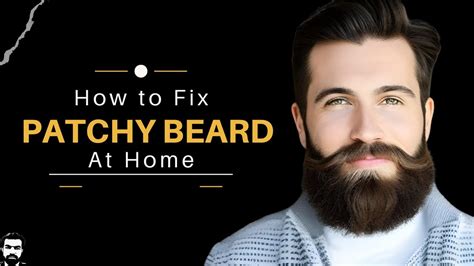 How To Fix A Patchy Beard At Home Natural Remedies For Beard Growth