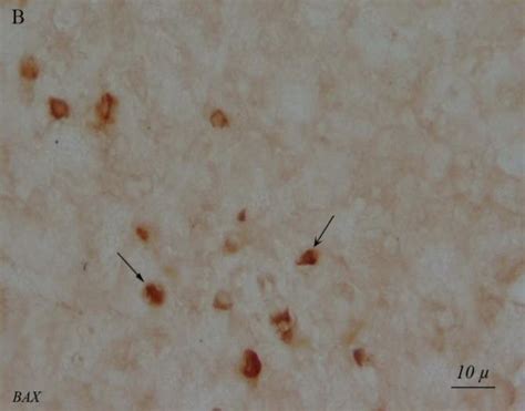 Light Photomicrographs Show Immunohistochemical Expression Of Bax In