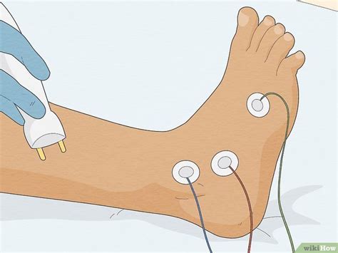 How To Know If You Have Neuropathy In Your Feet 6 Signs Artofit