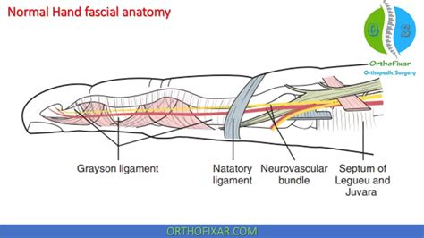 Dupuytren Contracture Easy Explaned Orthofixar 2025