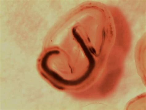 Parasitic Worms Having Sex Youtube