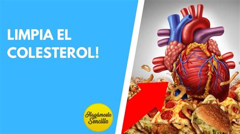 LIMPIA Tus ARTERIAS De COLESTEROL Sin MEDICACION Los MEJORES ALIMENTOS