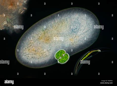 Einzellige ciliaten Fotos und Bildmaterial in hoher Auflösung Alamy