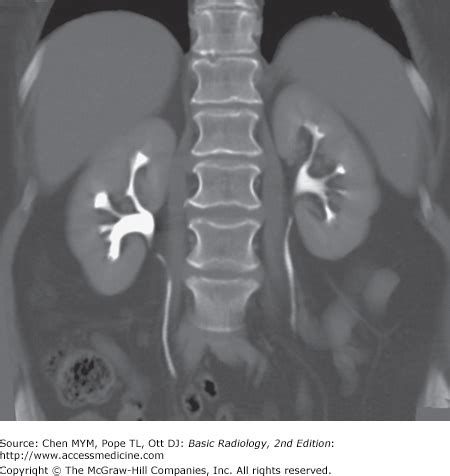 Chapter 9 Radiology Of The Urinary Tract Radiology Key