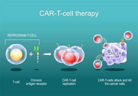 Car T Cell Therapy Cancer Immunotherapy Royalty Free Vector