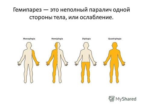 Презентация на тему: "Пораж". Скачать бесплатно и без регистрации.