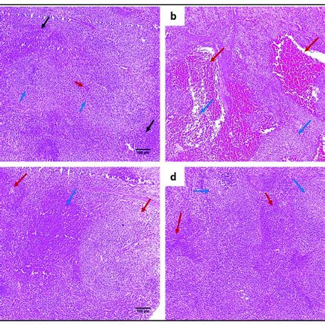 Hande Micrographs Of Spleen Sections Of A Normal Spleen Showing Download Scientific Diagram