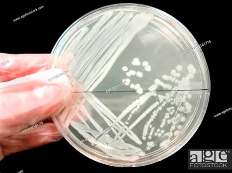 Bacterial Pathogen Colony On An Agar Streak Plate In A Medical