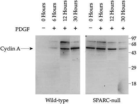 Primary Mesenchymal Cells Isolated From Sparc Null Mice Exhibit Altered