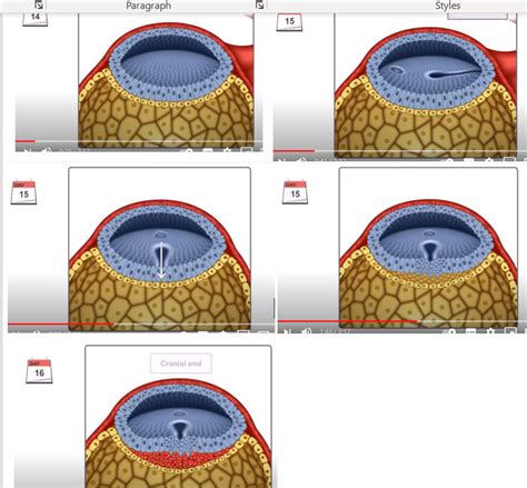 gastrulation Diagram | Quizlet