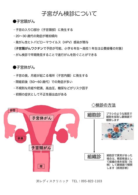 子宮ガン検診について｜長崎市の産婦人科 渕レディスクリニック