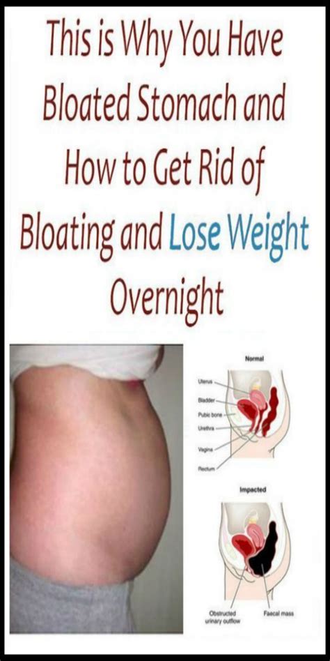 Reasons Why Your Stomach Is Bloated And How To Get Rid Of It Artofit