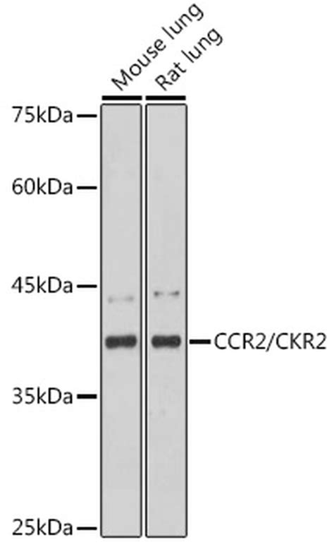 CCR2 Recombinant Monoclonal Antibody (10L1L6) (MA5-42780)