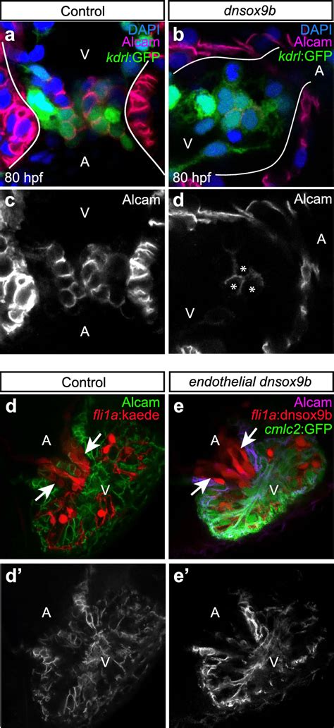 Cardiomyocyte Specific But Not Endothelial Specific Inhibition Of Sox B