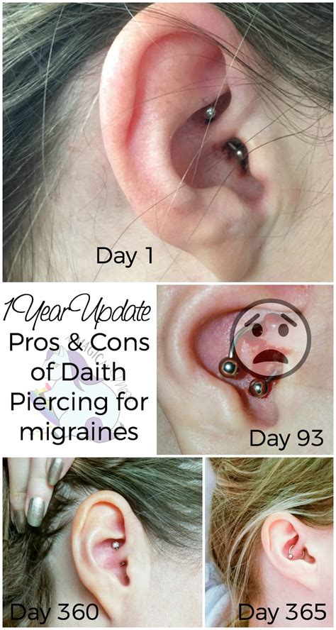 Daith Piercing Healing Time