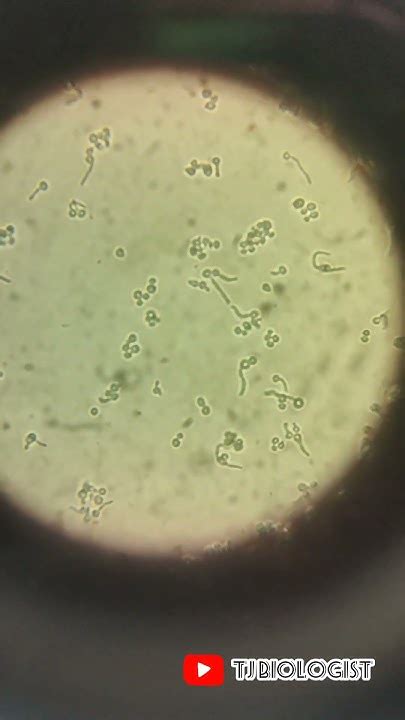 Germ Tube Test Candida Albicans Fungal Spore Clinical Microbiology Reynolds Braude