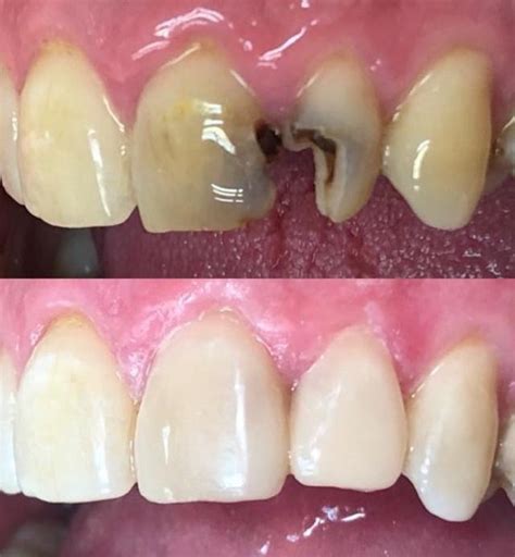 Odontología restauradora Clínica dental Sánchez Campos