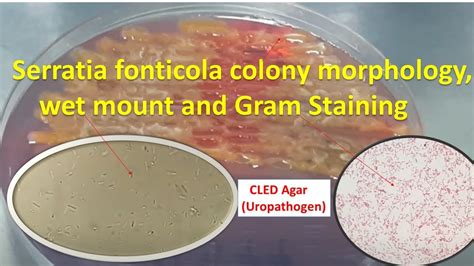 Serratia Fonticola Colony Morphology Wet Mount And Gram Staining Youtube