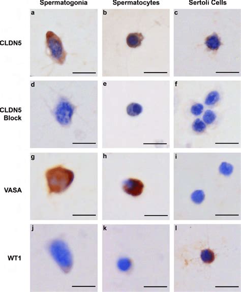 CLDN5 Expression In Germ Cells And Sertoli Cells Isolated From