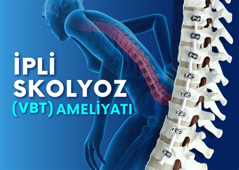 Pli Skolyoz Ameliyat Vertebral Body Tethering Turan Turan