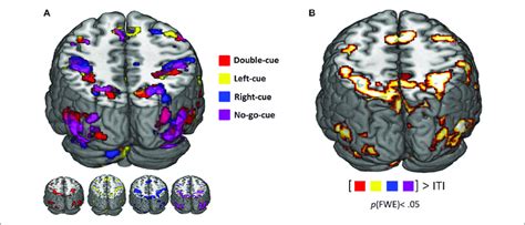 A Functional Magnetic Resonance Imaging Fmri Activity Related To Download Scientific