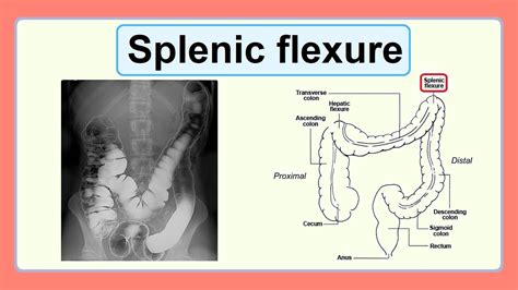 Splenic Flexure Youtube