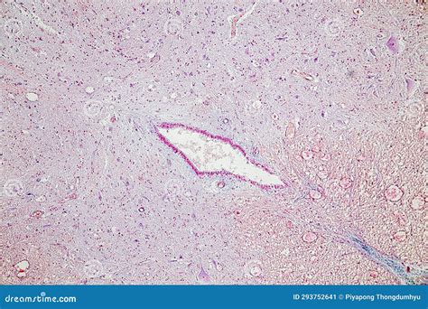 Motor Neuron Spinal Cord Nerve Fibres And Nerve Cells Under The Microscope Stock Image