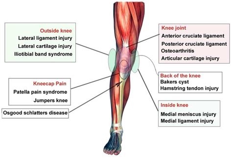 Knee Problems And Chiropractic Care Natural Results Chiropractic