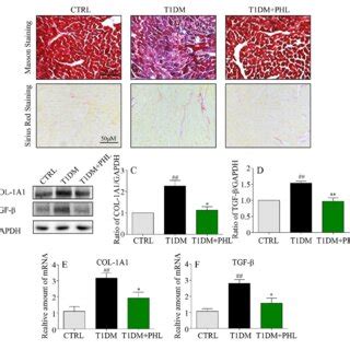 Phloretin Reduced Hyperglycemia Induced Inflammation In The Heart Of