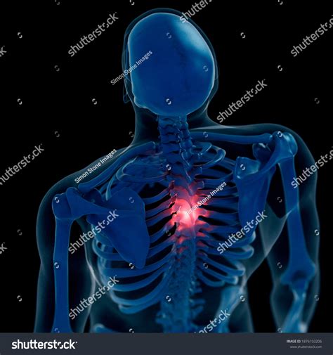 Illustration Painful Thoracic Spine Stock Illustration 1876103206 | Shutterstock