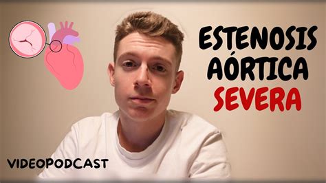 Estenosis Aórtica Severa 😱 Videopodcast Youtube